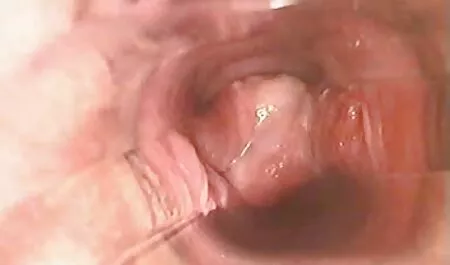 सुंदर गोरा सेक्सी पिक्चर हिंदी मूवी सबसे अच्छा गुदा मैथुन - बड़ा सह शॉट